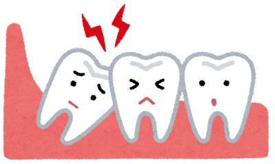 抜歯を検討している方へ。親知らずの抜歯体験１日目